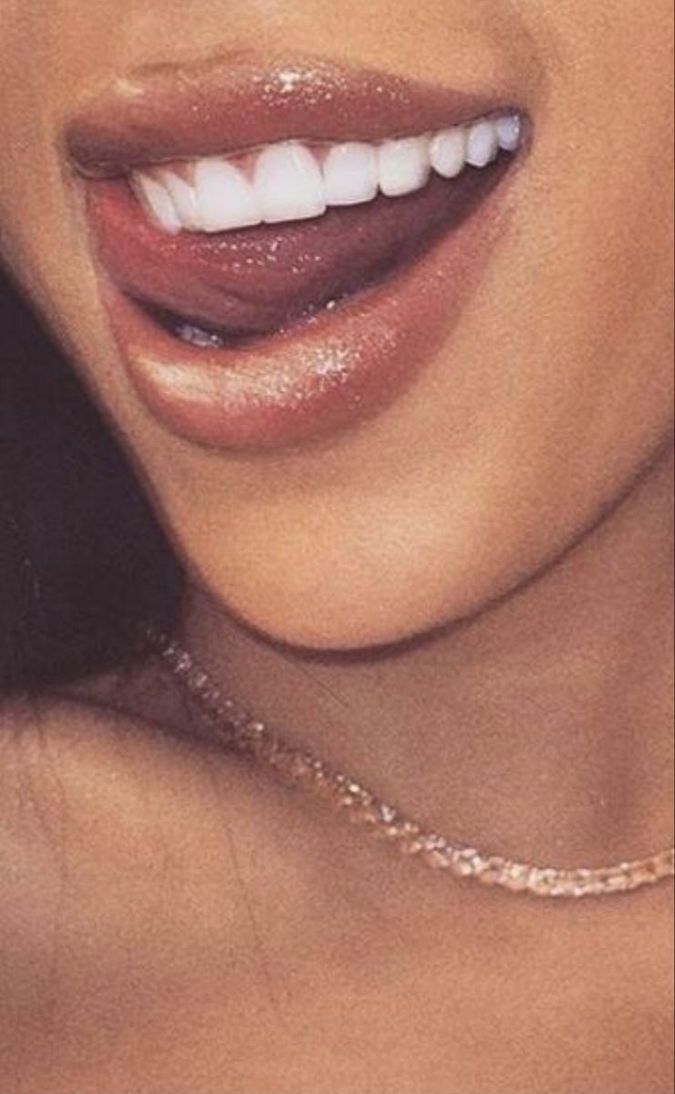 teeth whitening vaughan