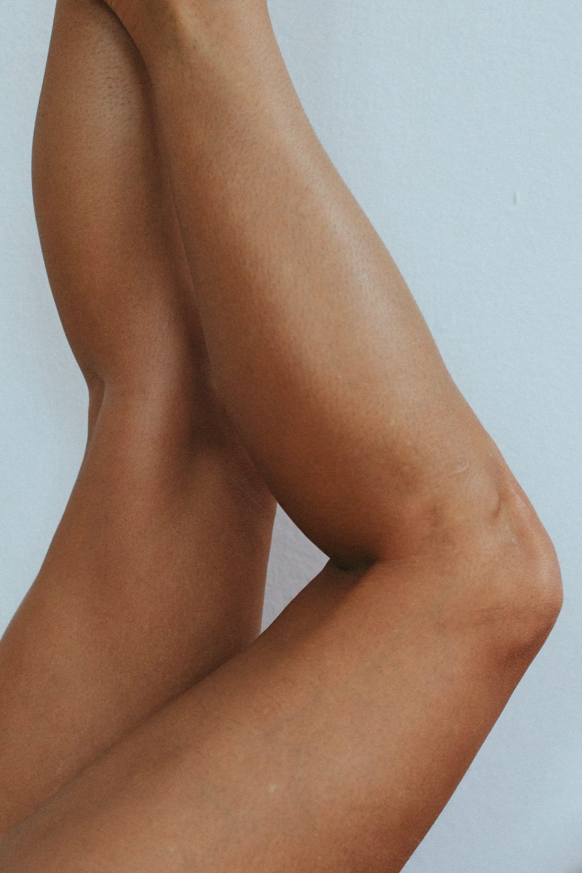 best laser hair removal